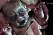 寶寶不開心！巴西嬰兒「一出生就氣噗噗」皺眉表情瞬變網紅…網笑：一定是還不想出來！