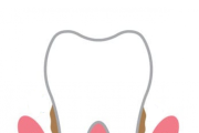 台中牙齒矯正黃汝萍醫師：有牙周病想進行「牙齒矯正」必看完這一篇
