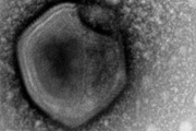 100萬年前「殭屍病毒」將復活！流行病恐大爆發
